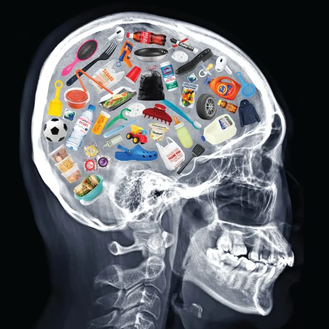 plastic_in_brain.jpg